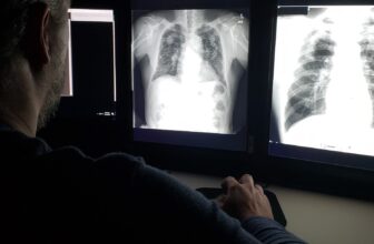 Lung Power Peaks in Our 20s—and I...